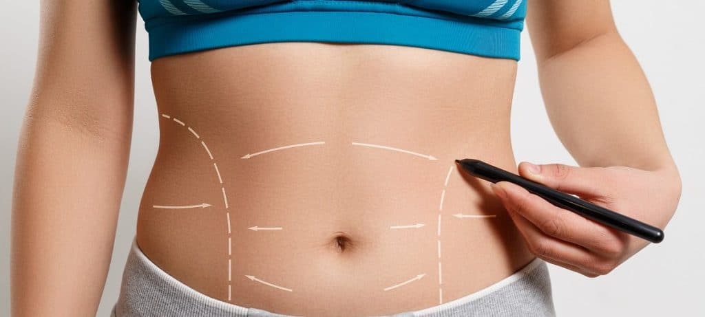 Importance of Liposuction