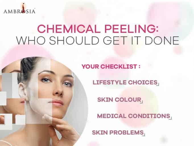 Chemical Peeling Who Should Get It Done?