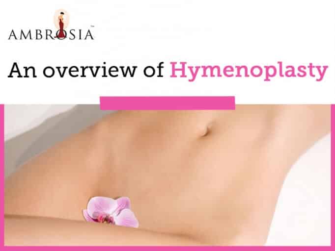 An Overview of Hymenoplasty