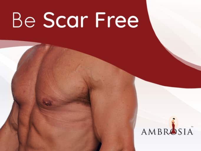 An Image of Be Scar Free