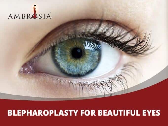Blepharoplasty