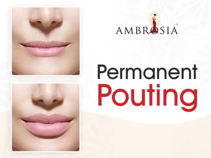 Permanent Pouting