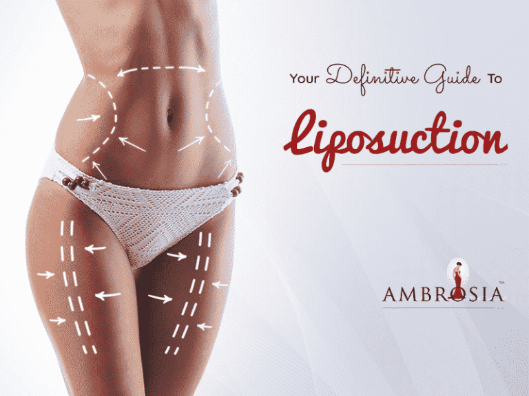 A Guide to Liposuction - Ambrosia Clinic