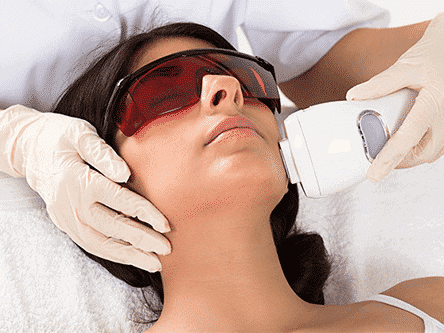 Laser Treatment