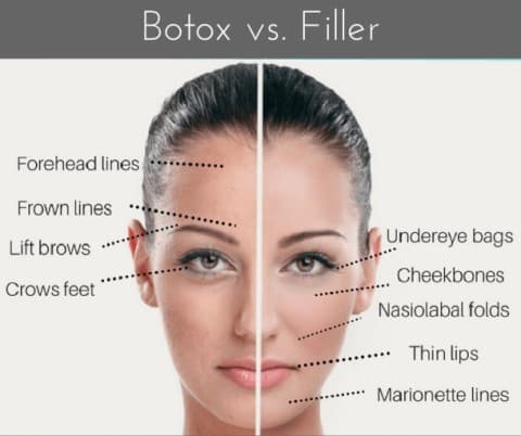 Botox and Cosmetic Fillers
