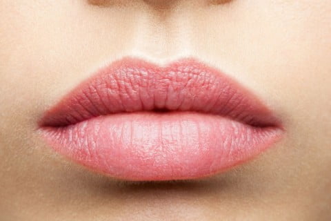 Lip Augmentation