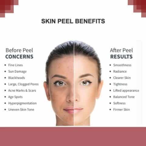  Skin Issues