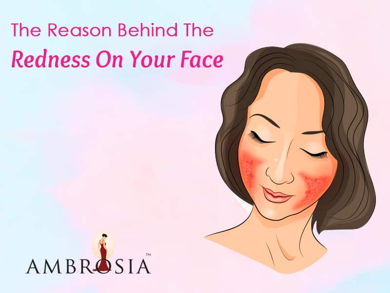 The Reason Behind The Redness On Your Face