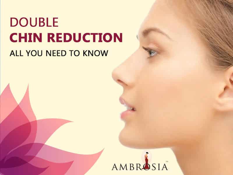 double chin reduction