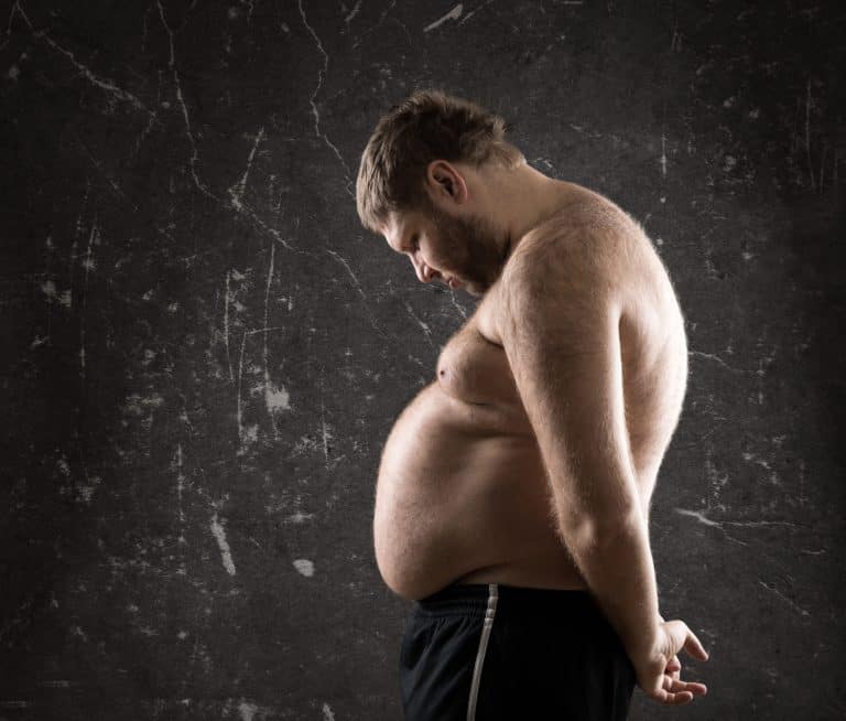 man with chest fat (Gynecomastia)