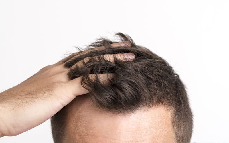Hair Care / Hair Transplant
