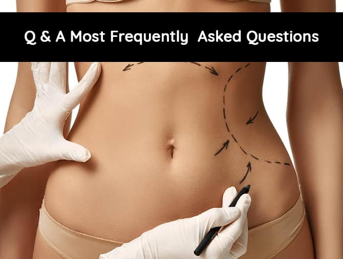 Abdominoplasty Surgery: A Complete Answer Guide To Your Every Question