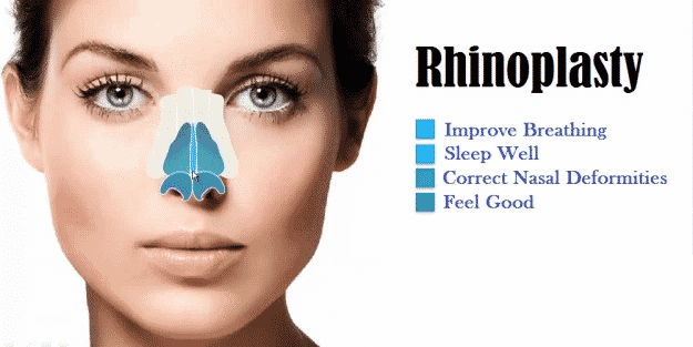 Top 10 Benefits of Breast Augmentation Rhinoplasty Surgery: A Complete Guide to Nose Surgery Benefits, Treatment, Cost and Results