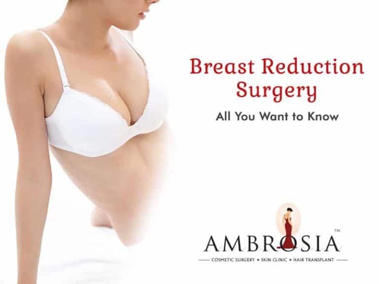 Breast Reduction Surgery - Ambrosia Clinic