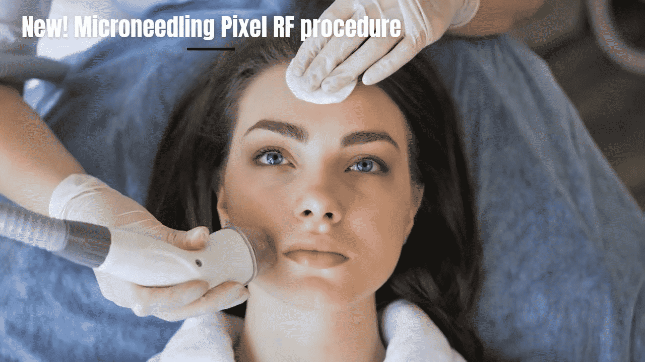 Acne Scar Treatment