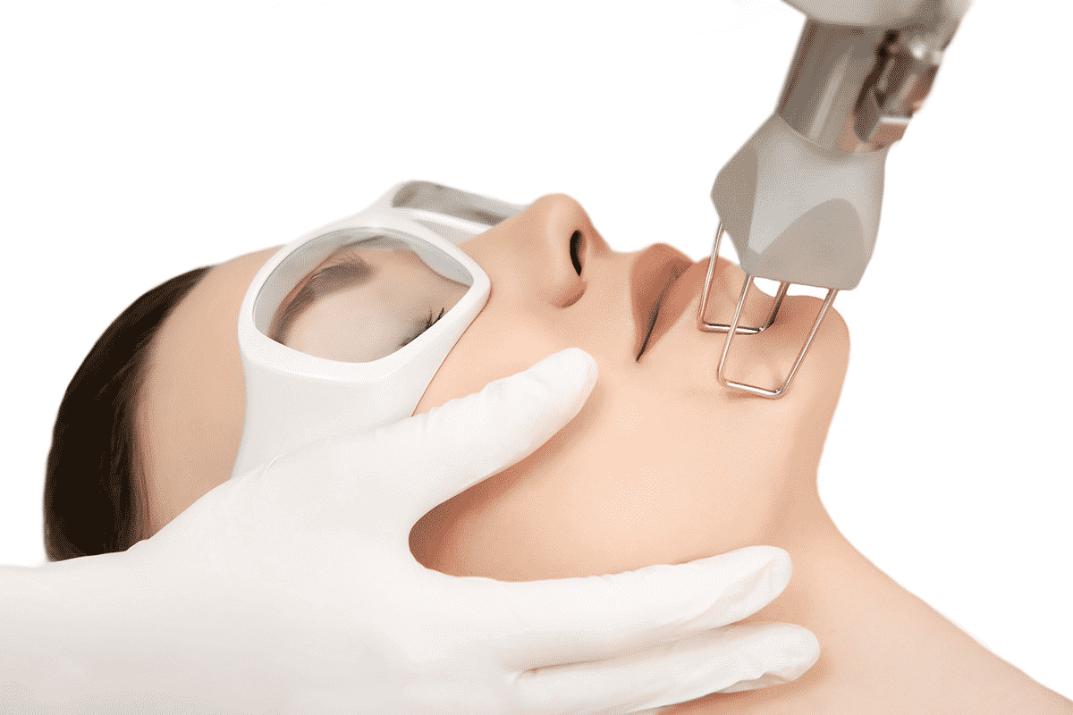 Acne Scar Treatment