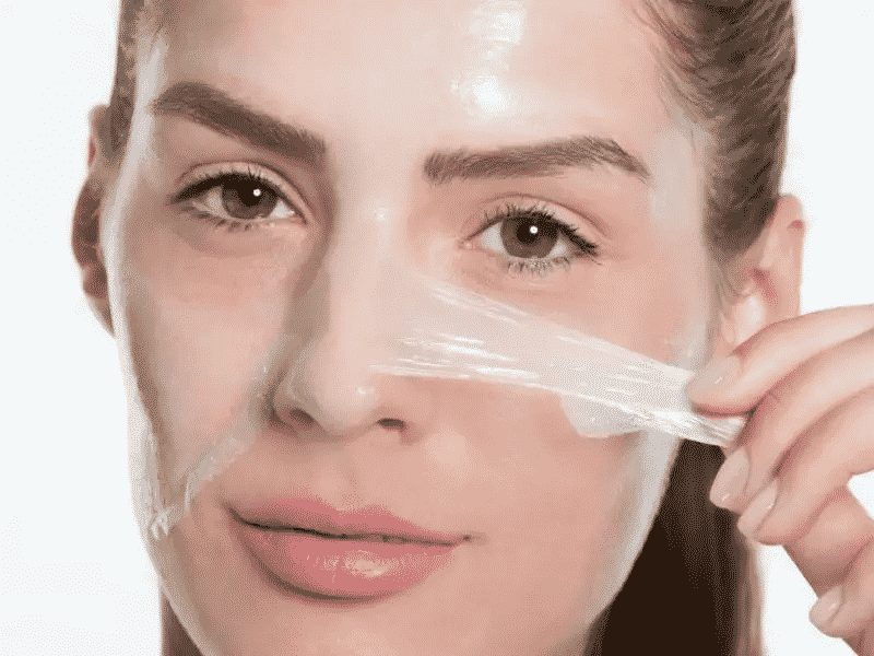 Acne Scar Treatment