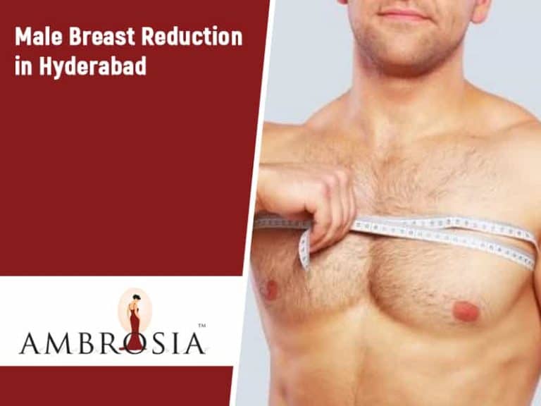 Male Breast Reduction In Hyderabad