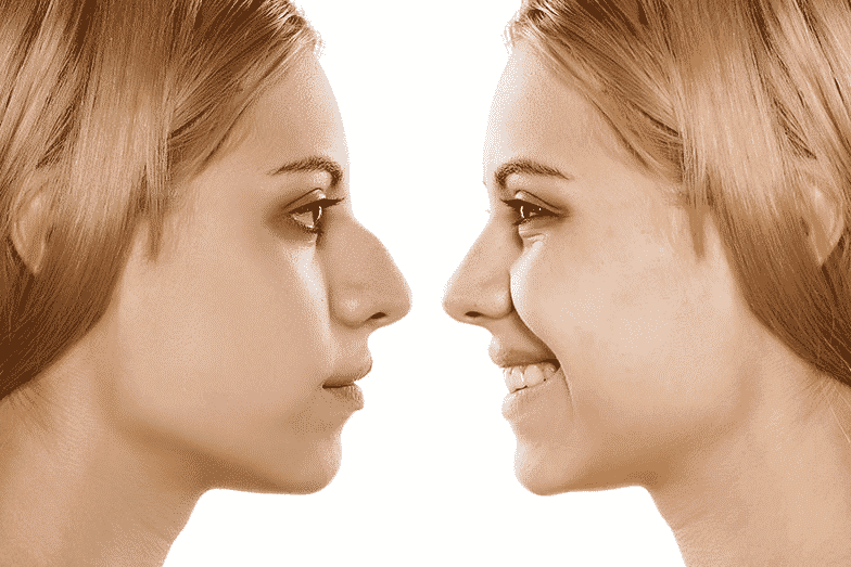 Top 10 Benefits of Breast Augmentation Rhinoplasty Surgery: A Complete Guide to Nose Surgery Benefits, Treatment, Cost and Results