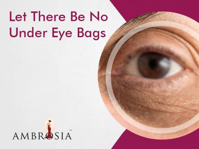 Under Eye Bags