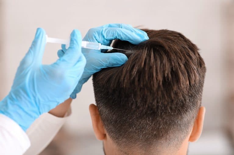 All You Need To Know About Hair Transplant Surgery