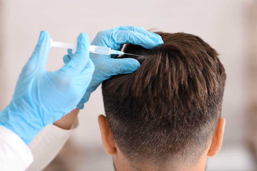 All You Need To Know About Hair Transplant Surgery