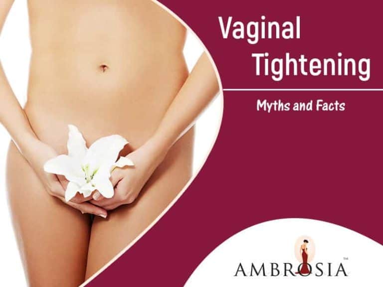 Vaginal Tightening: Myths and Facts