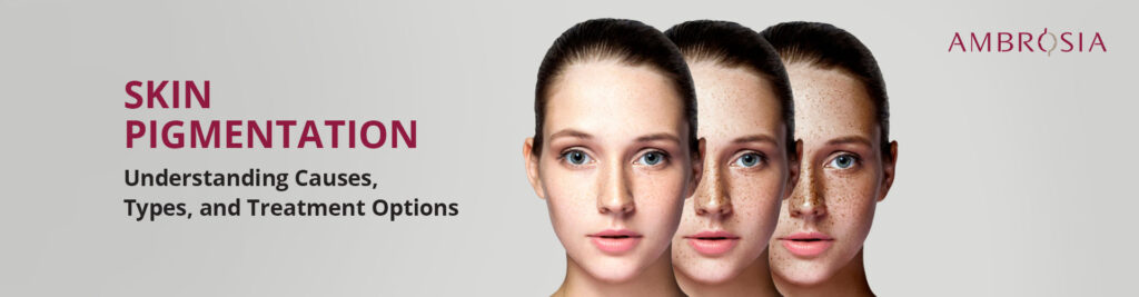 Skin Pigmentation Disorders: Understanding Causes, Types, and Treatment Options