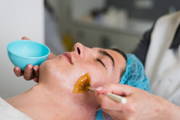 Chemical Peeling Treatment In Hyderabad, India: Costs, Types & Benefits