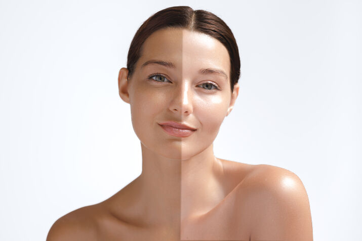a lady whose left side is tanned and right side is bright